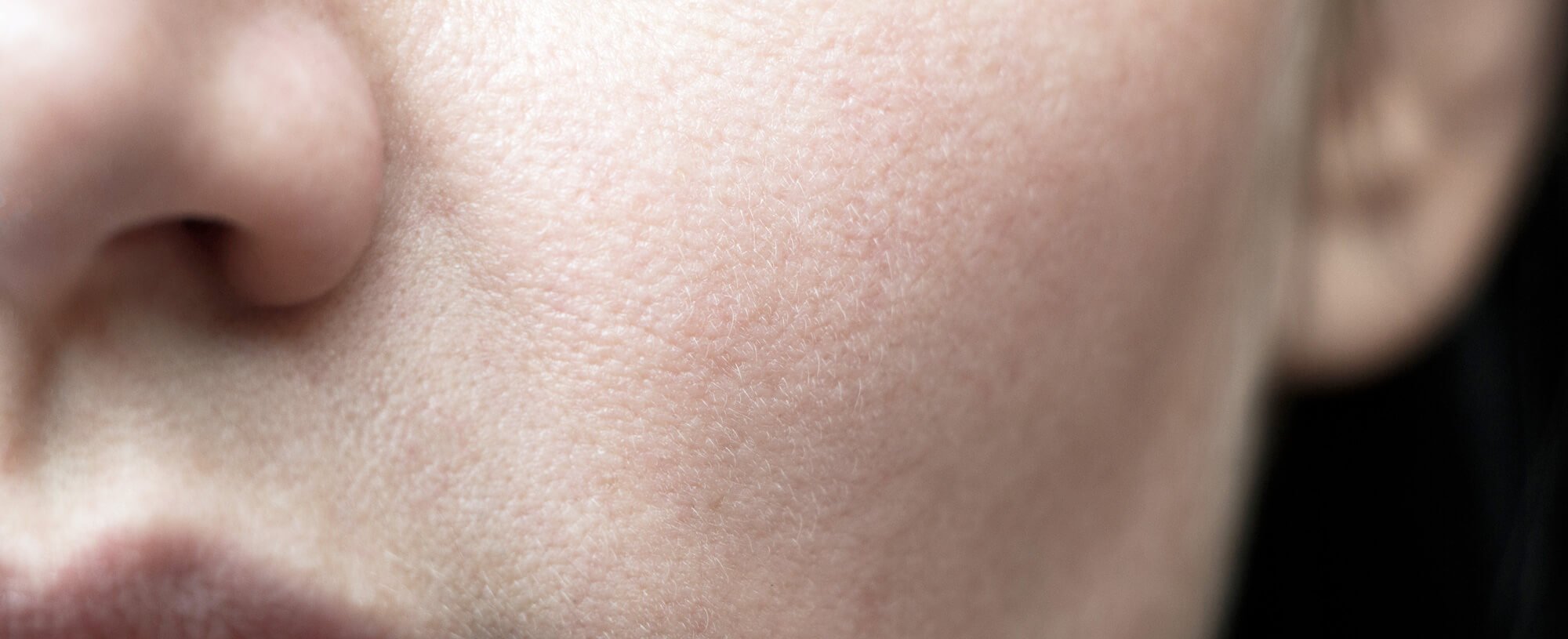 The 5 Beauty Benefits Of Glycolic Acid Article