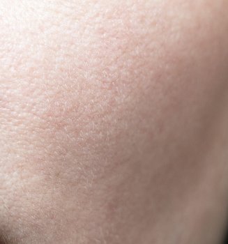 The 5 Beauty Benefits Of Glycolic Acid Article