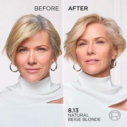 Before After
