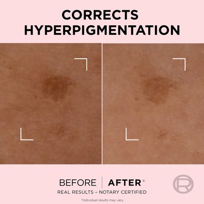 Rapid Spot Corrector 4