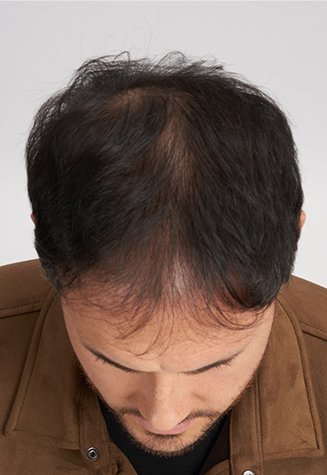 Growth Booster Serum After Mobile