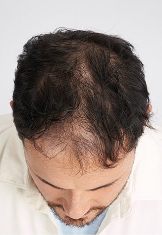 Growth Booster Serum Before Mobile