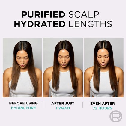 Hydra Pure Before After