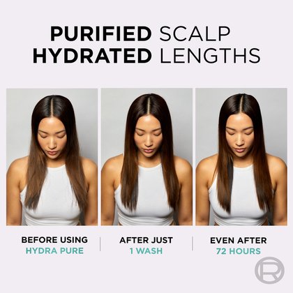 Hydra Pure Before After 2