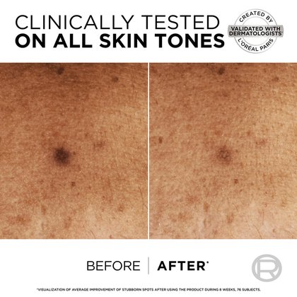 Niacinamide Dark Spot Routine Duo Kit 2