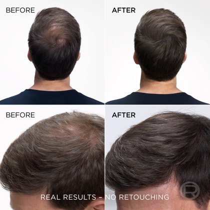 Unretouched before-and-after photos showing the dramatic scalp coverage and hair volumizing results of L'Oréal Paris Magic Retouch on a man's thinning crown.