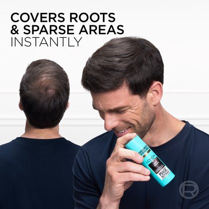 A close-up of a man holding L'Oréal Paris Magic Retouch in Dark Brown, showing how the instant concealer spray easily covers roots and sparse areas on the crown.