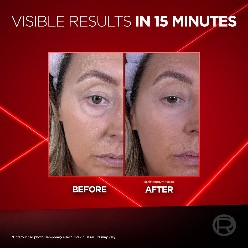 Loreal Revitalift Eye Bag Instant Eraser before and after application