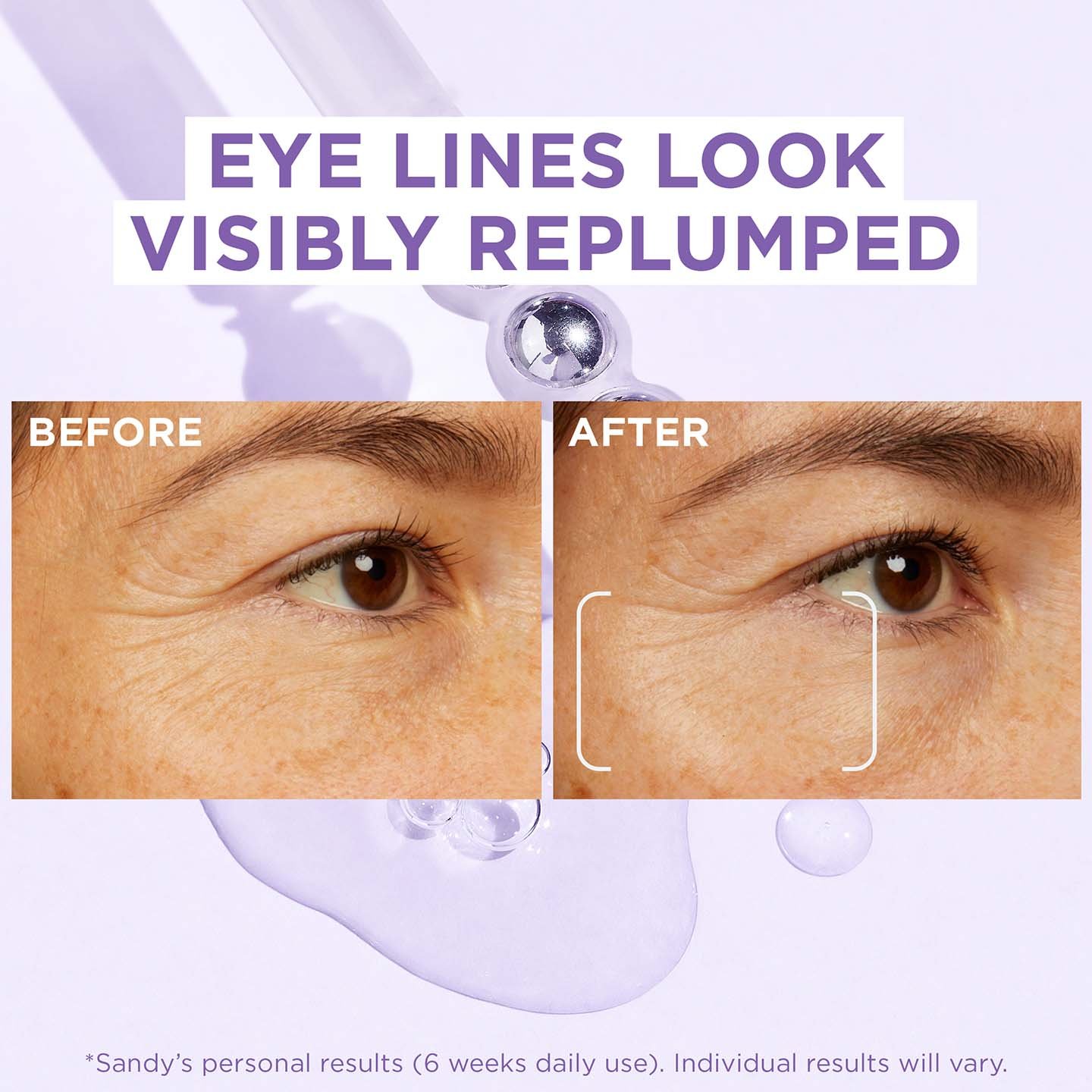 Hyaluronic Acid and Caffeine Eye Serum L'Oréal Paris UK