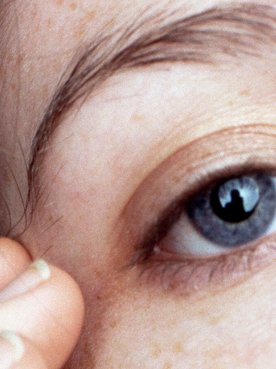 How To Choose The Right Concealer To Banish Dark Circles Hero